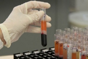 Laboratórios Buscam Kit Diagnóstico  De Massa Para Detectar O Zyka Vírus