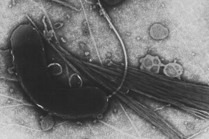 Cientistas Investigam Origem De Bactéria Pandêmica Causadora Do Cólera