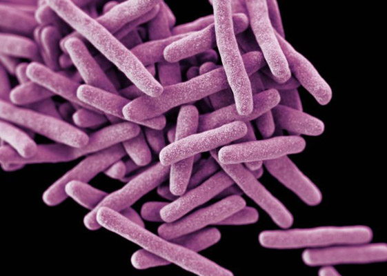 Diagnóstico Da Tuberculose Ficará Mais Rápido